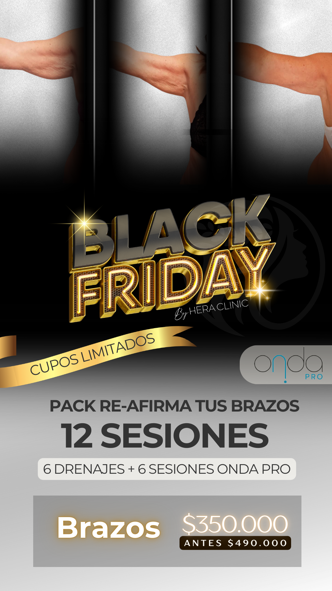 Pack Re-Afirma Tus Brazos – 12 Sesiones (Black Friday)