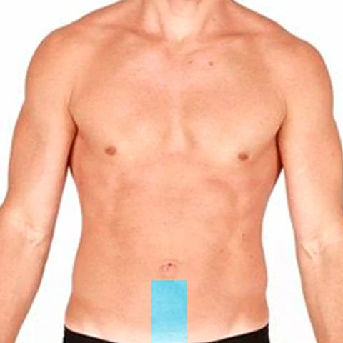 LÍNEA ALBA 6 SESIONES SOPRANO ICE