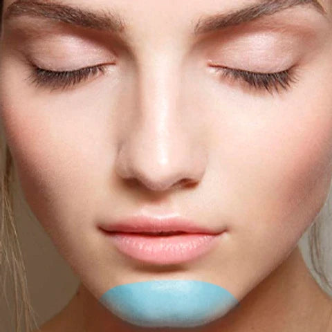 MENTÓN 8 SESIONES SOPRANO ICE